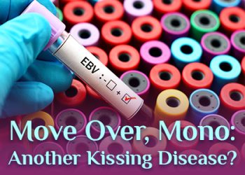 North Reading dentists at Inertia Dental talk about a kissing disease you might be less familiar with than mononucleosis
