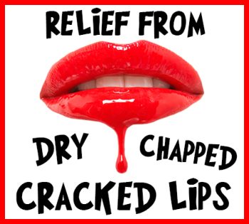 North Reading dentist, Dr. Judy Marcovici at Inertia Dental, tells you how to relieve your dry, chapped, and cracked lips!