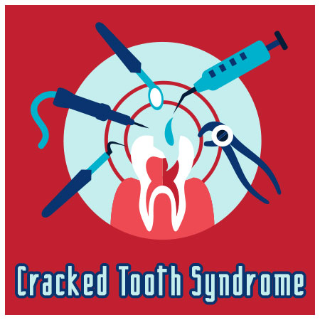 North Reading dentist, Dr. Judy Marcovici at Inertia Dental, discusses causes, symptoms, and treatment of cracked tooth syndrome.