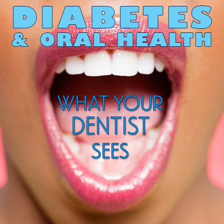 North Reading dentists at Inertia Dental discuss the side effects of diabetes and how it affects your oral health.