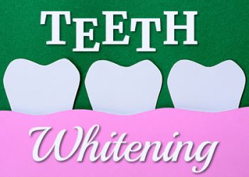 North Reading dentist, Dr. Judy Marcovici at Inertia Dental, shares everything you need to know about different types of teeth whitening.