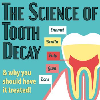 North Reading dentist, Dr. Marcovici of Inertia Dental, discusses the science of tooth decay: what it is and what you can do to prevent it.