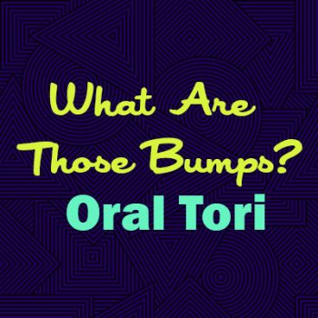 North Reading dentist, Dr. Judy Marcovici at Inertia Dental, explains oral tori: what they are, why they happen, and whether they are a cause for concern.