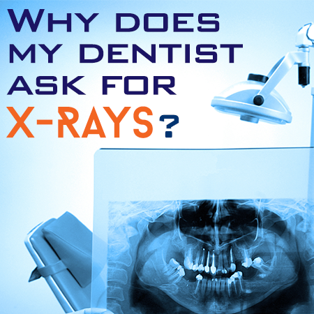 North Reading dentist, Dr. Judy Marcovici at Inertia Dental, discusses the importance of dental x-rays for accurate diagnosis and treatment planning.