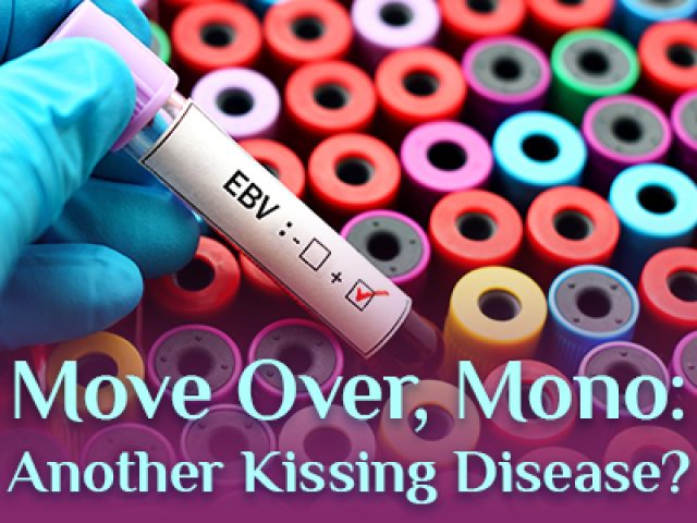 Move Over, Mono: Another Kissing Disease? (featured image)