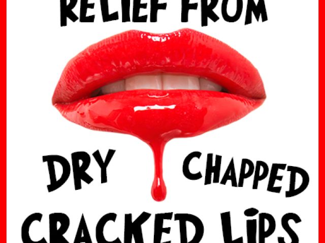 Relief from Dry, Chapped & Cracked Lips (featured image)