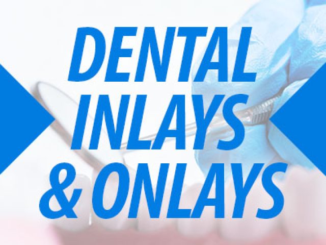 Dental Inlays & Onlays (featured image)