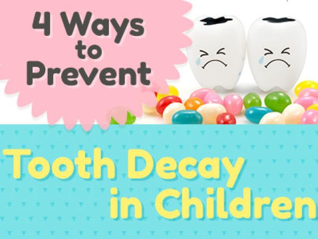 4 Ways to Prevent Tooth Decay in Children (featured image)