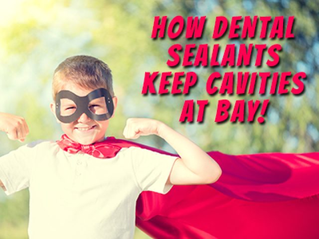 How Dental Sealants Keep Cavities at Bay! (featured image)