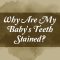 Why Are My Baby’s Teeth Stained? (featured image)