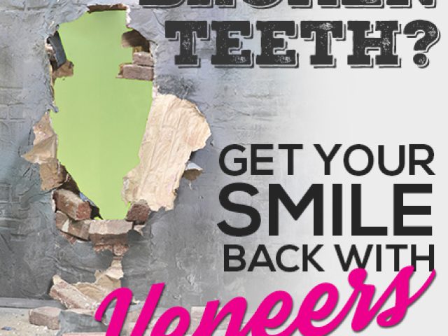 Veneers Can Give You Back Your Smile! (featured image)